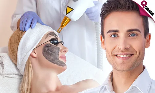 Carbon Laser Peel + Consultation for Ladies & Men!